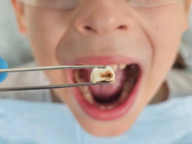 Best Emergency Cosmetic Dentistry (e.g., broken veneers) in Myrtletown, CA